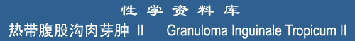 Granuloma II