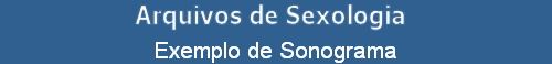 Exemplo de Sonograma