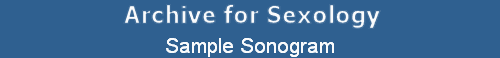 Sample Sonogram